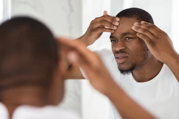 Problem Skin. Concerned Black Guy Inspecting Face, Noticed Pimple On Forehead — Foto de Stock