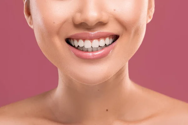 Female smile. Unrecognizable woman smiling, showing perfect white teeth — Fotografia de Stock