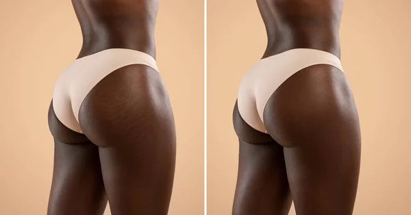 Before and after collage, black woman buttocks — Stock Photo, Image