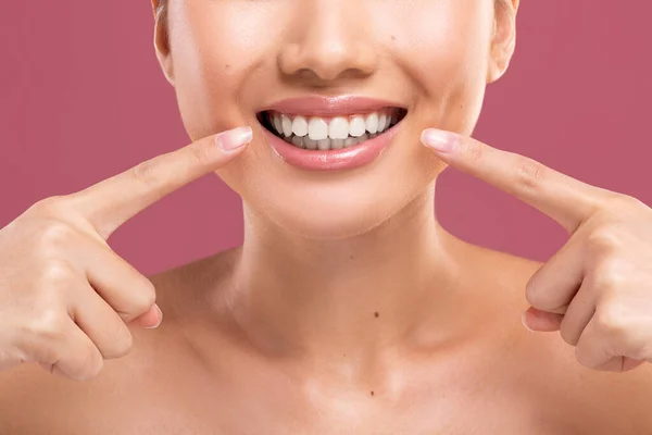 Mujer irreconocible sonriendo, mostrando sus dientes blancos perfectos — Foto de Stock