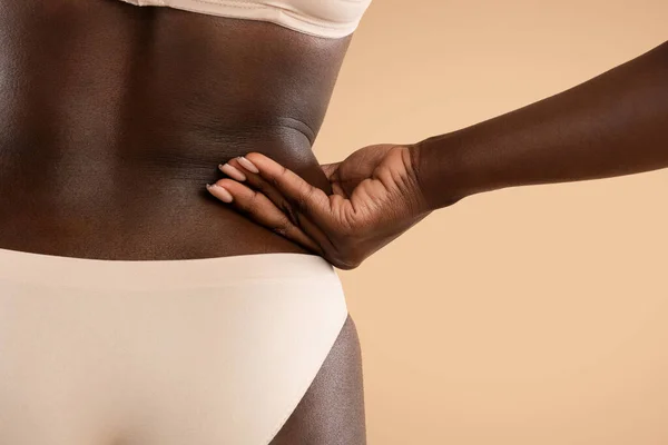 Vista posterior de la mujer negra tirando de la piel en sus lados — Foto de Stock