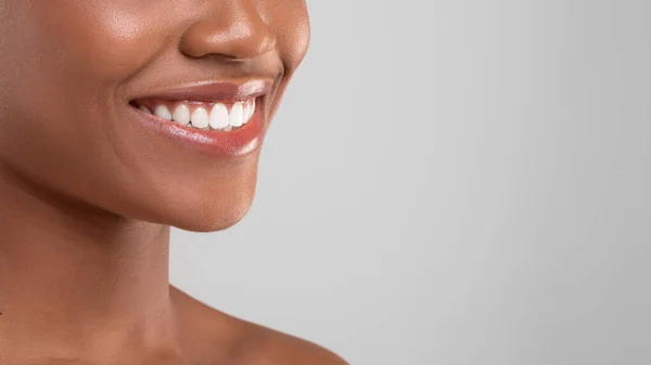 Diş Reklamları. Genç Siyah Kadının Güzel Gülümsemesinin Yakın Çekimi — Stok fotoğraf