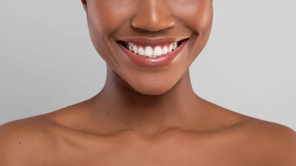 Cuidados dentários. close up retrato de sorriso afro-americano fêmea com dentes perfeitos — Fotografia de Stock