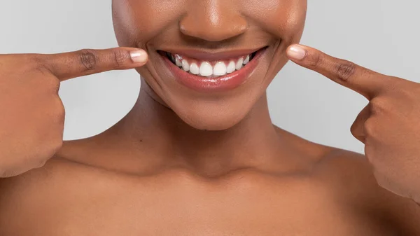 Sorrindo milenar afro-americano feminino apontando os dedos para a neve perfeita sorriso branco — Fotografia de Stock