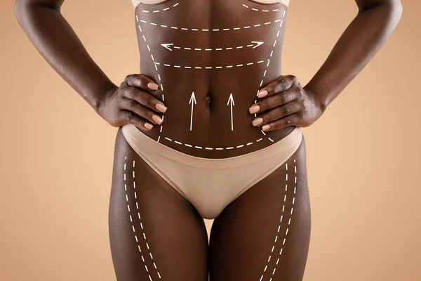 Cropped of african american woman in underwear before surgery — Stock Photo, Image