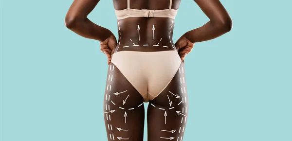 Visão traseira da mulher americana africana em roupa interior antes da cirurgia — Fotografia de Stock