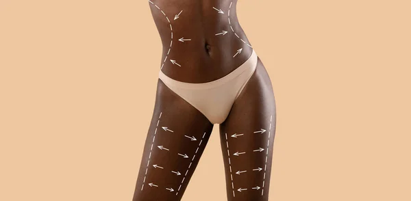 Cropped of slim black woman in underwear before surgery — Stock Photo, Image