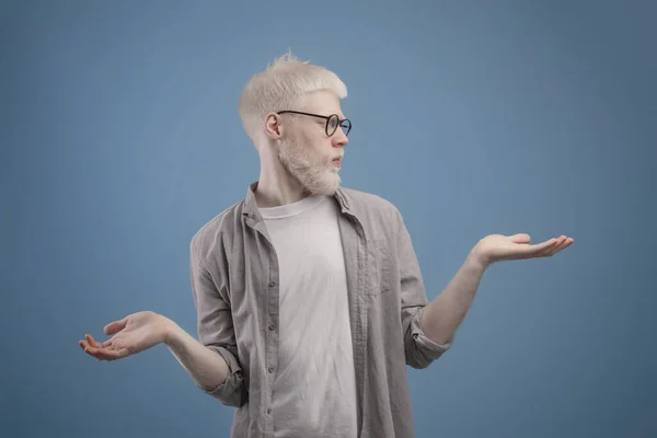 Membuat pilihan. Pria albino muda membuat timbangan dengan tangan kosong, pria yang meragukan membandingkan pilihan, menyalin ruang — Stok Foto