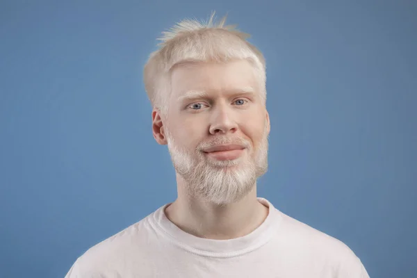 Cilt anormalliği konsepti. Mavi stüdyo arka planında kameraya poz veren sakallı yakışıklı albino adamın portresi — Stok fotoğraf