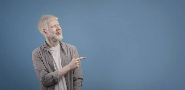 Önüne bak. Genç albino adam işaret ediyor ve reklam metni için kopya alanı gösteriyor, mavi arkaplan — Stok fotoğraf