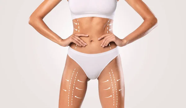 Slimming. Closeup of Unrecognizable Lady Posing With Drawn Arrows — Stockfoto