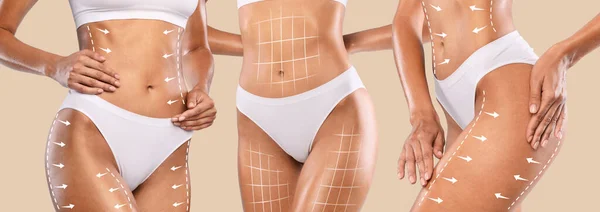 Body Lift Konzept Weibliche Körper Mit Lifting Linien Und Pfeilen — Stockfoto