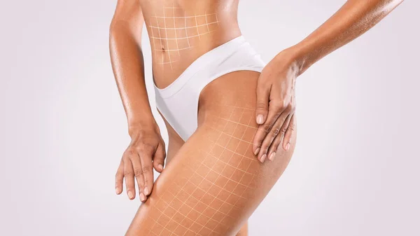 Tratamento Celulite Levantando Linhas Desenhadas Corpo Feminino Perfeito Roupas Íntimas — Fotografia de Stock