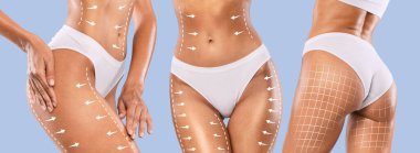 Estetik cerrahi. Kadın iç çamaşırlı, halat ve okları kaldıran, tanınmayan bir grup kadın, liposuction, yaratıcı kolaj ve panorama sonrası mükemmel vücut şeklini gösteriyor.