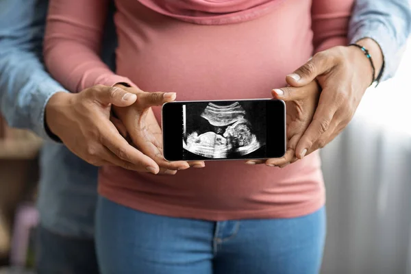Casal Grávida Preto Irreconhecível Segurando Smartphone Com Sua Foto Ultrassonografia — Fotografia de Stock