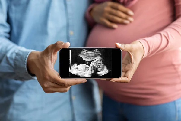 Black Pregnant Couple Holding Smartphone Baby Ultrasound Image Closeup Shot — Zdjęcie stockowe