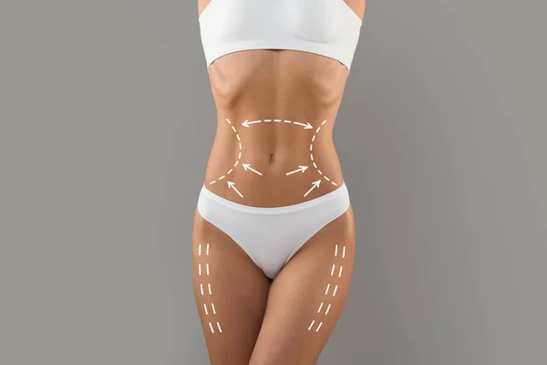 Body Contouring Concept. Cropped Shot Of Slim Female Torso With Drawn Lifting Up Lines On It, Unrecognizable Woman In White Underwear With Perfect Figure Standing On Grey Studio Background, Collage