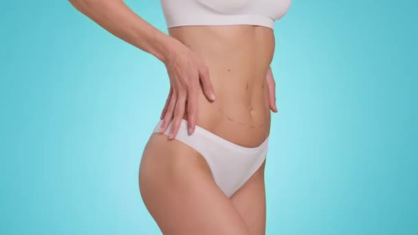 Plastic Surgery Concept Unrecognizable Fit Woman Demonstrating Perfect Figure Belly — Stock video