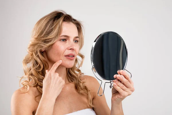 Frustrated Middle Aged Lady Holding Mirror Looking Pimple Her Face — Stockfoto