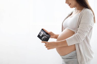 Beyaz arka planda durup bebeğinin sonogramına, fotokopi alanı olan panorama ve kırpılmış fotoğrafına bakan ev elbiseli bir kadın. Fetüsün ultrason görüntüsü, embriyo.