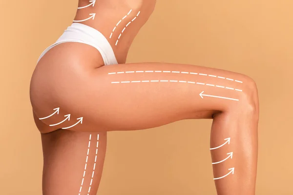 Closeup Cropped Shot Young Woman White Panties Posing Massage Lines — Stock Photo, Image