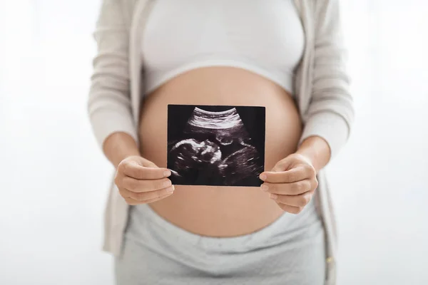 Beskuren Väntar Kvinna Bekväma Kläder Visar Ofödda Baby Ultraljud Bild — Stockfoto