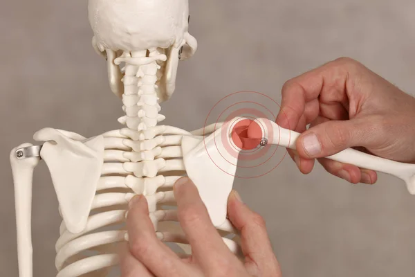 肩関節痛 理学療法 手術回復の概念 — ストック写真