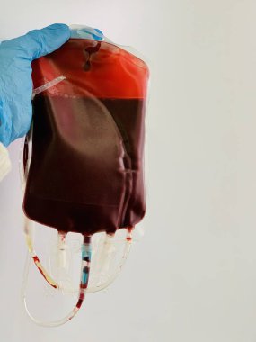 Elinde kan torbası var. Kan torbasında kırmızı kan..