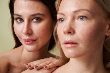 Esmer, sorunlu bir kadın ve çıplak omuzları çilli bir kadına bağlanıyor.