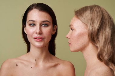 Sivilceli bir kadın kameraya dikkatle bakıyor.