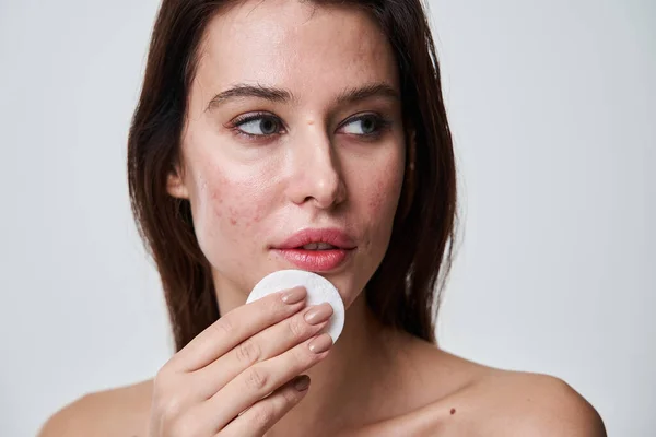 Serious woman with problematic skin hiding her chin behind the cotton pad — Stock Photo, Image
