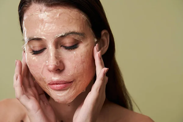 Mujer con manchas post acné en su cara mirando hacia abajo y tocando su cara — Foto de Stock