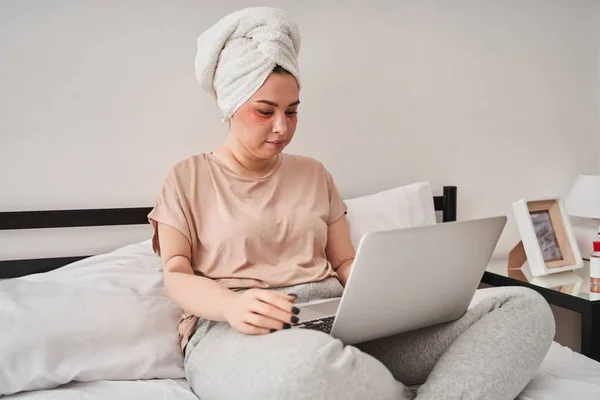 Γυναίκα με βιονικό άκρο κάθεται στο κρεβάτι και κοιτάζοντας την οθόνη του φορητού υπολογιστή — Φωτογραφία Αρχείου