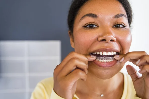 Mulher Multirracial Sorridente Com Dentes Saudáveis Usando Aparelho Removível Claro — Fotografia de Stock