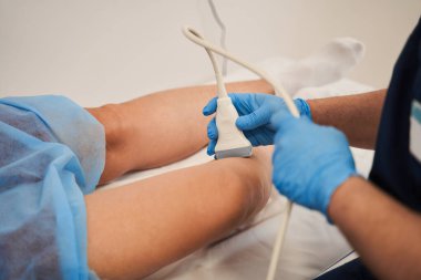 Doktor hastaların bacaklarında ultrason yapar, kapat. Phlebologist bir hastayı taramak için ultrason makinesi kullanır. Doktor hastaların bacaklarındaki damarları makineyle kontrol ediyor.