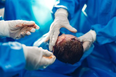 Profesyonel anestezi uzmanı doktor tıbbi ekip ve asistan bebek sezaryeni yapıyor ve bebeği modern hastane ameliyathanesinde doğum ekipmanıyla doğuruyor.