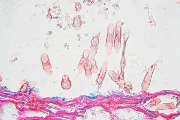 Agente Patogeno Vegetale Botrytis Allii Microscopio — Foto Stock