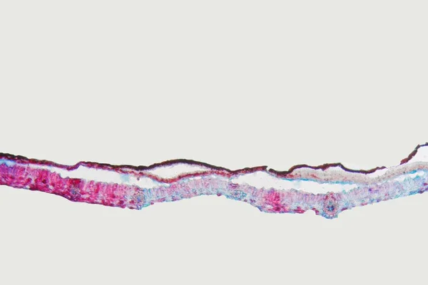 Plant Pathogeen Rhytisma Acerinum Zwarte Vlek Ziekte Een Esdoorn Blad — Stockfoto