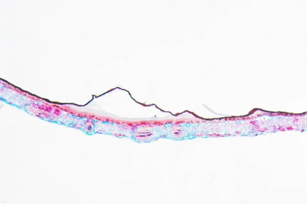 Agent Phytopathogène Rhytisma Acerinum Maladie Des Taches Noires Sur Une — Photo