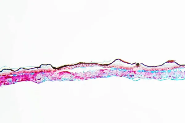 镜下枫叶上的黑斑病病原菌黑斑病 — 图库照片