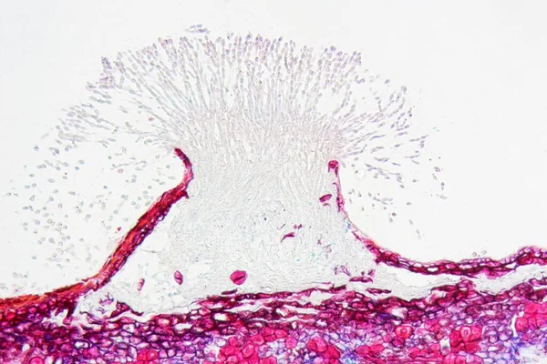 Patogen Roślinny Monilinia Fructigena Pod Mikroskopem — Zdjęcie stockowe