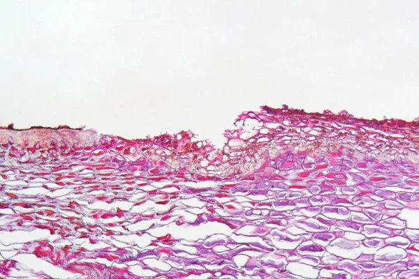 The plant pathogen pear scrap, Venturia pyrina under the microscope.