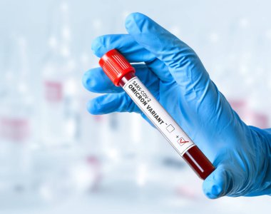  Coronavirus SARS-CoV-2. Omicron varyantı. Elinde koronavirüs testi olan tüp..