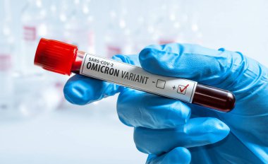  Coronavirus SARS-CoV-2 Omicron varyantı. Elinde koronavirüs testi olan tüp..
