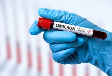  Coronavirus SARS-CoV-2 Omicron varyantı. Elinde koronavirüs testi olan tüp..