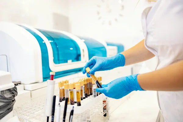 Тестові Трубки Зразками Крові Медсестра Стоїть Лабораторії Приймає Пробірки Зразками — стокове фото