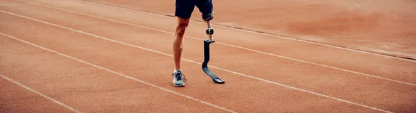 Handicapped Runner Artificial Leg Standing Running Track Legs Standing Running — Stock Photo, Image