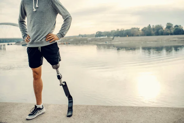 Skelede Elleri Kalçasında Duran Protez Bacaklı Formda Bir Sporcu Gururlu — Stok fotoğraf