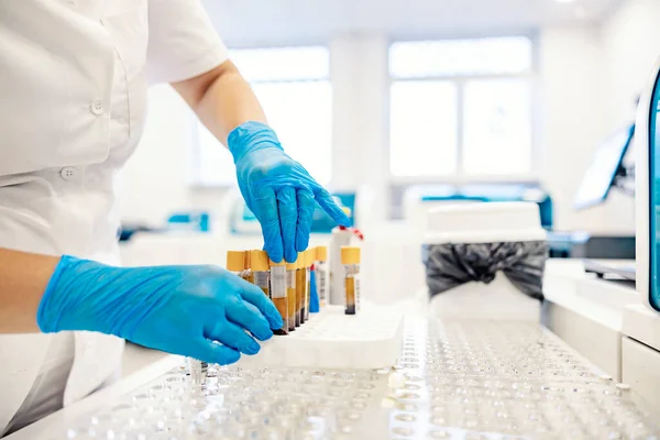 Tubos Ensaio Com Sangue Numa Prateleira Uma Enfermeira Está Laboratório — Fotografia de Stock