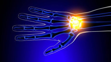 Bilek ya da bilek eklem ağrısı anatomisi Tıbbi Konsept 3 boyutlu görüntü için